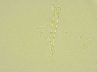 Thulinius saltursus image