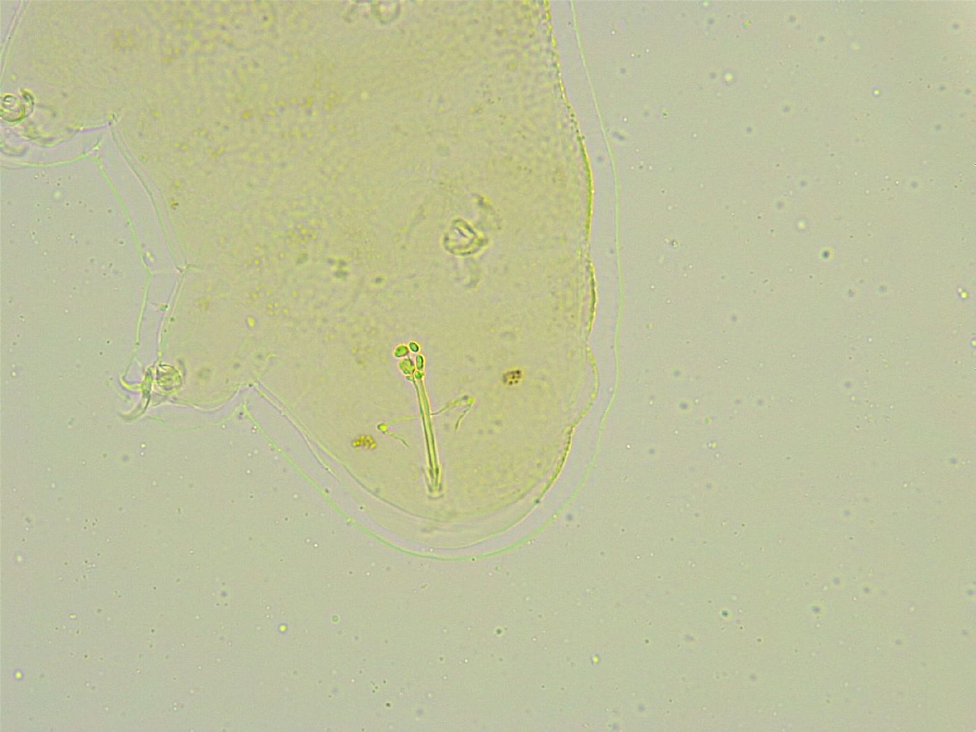 Isohypsibius tuberculatus image