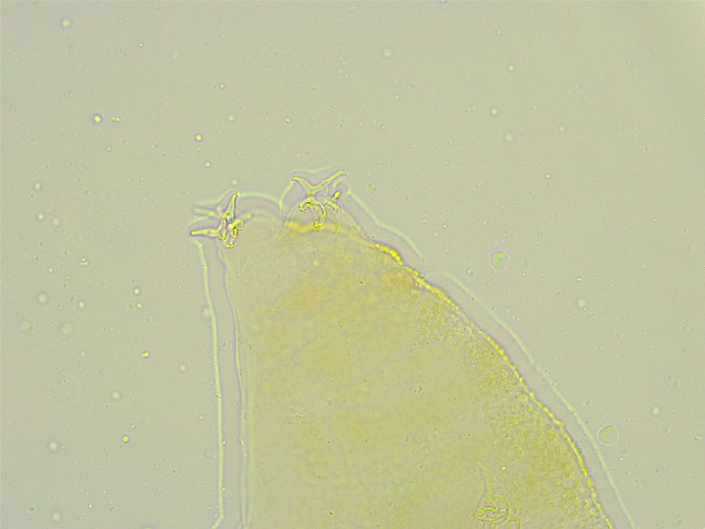 Isohypsibius tuberculatus image