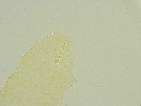 Isohypsibius tuberculatus image