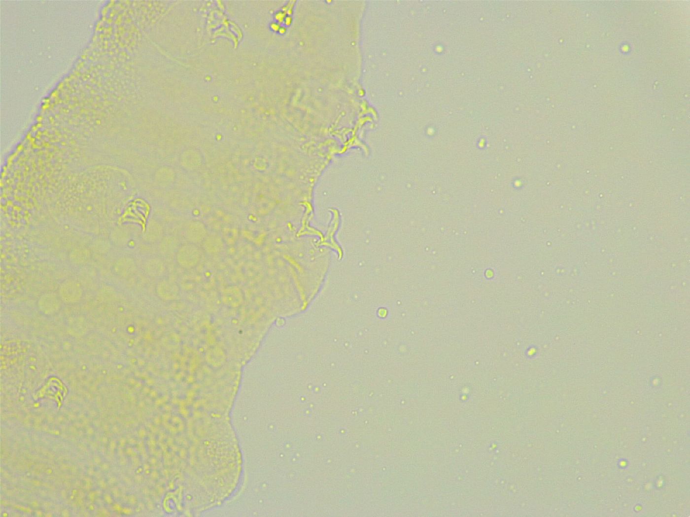 Isohypsibius tuberculatus image