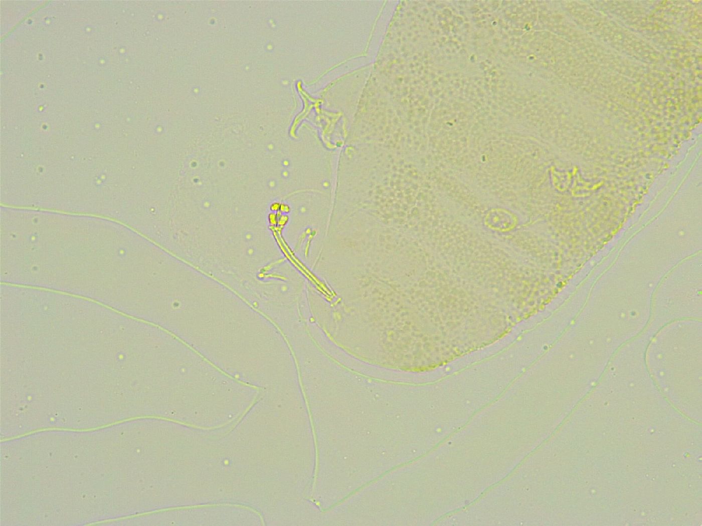 Isohypsibius tuberculatus image