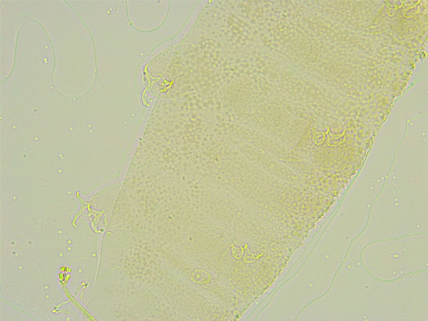 Isohypsibius tuberculatus image