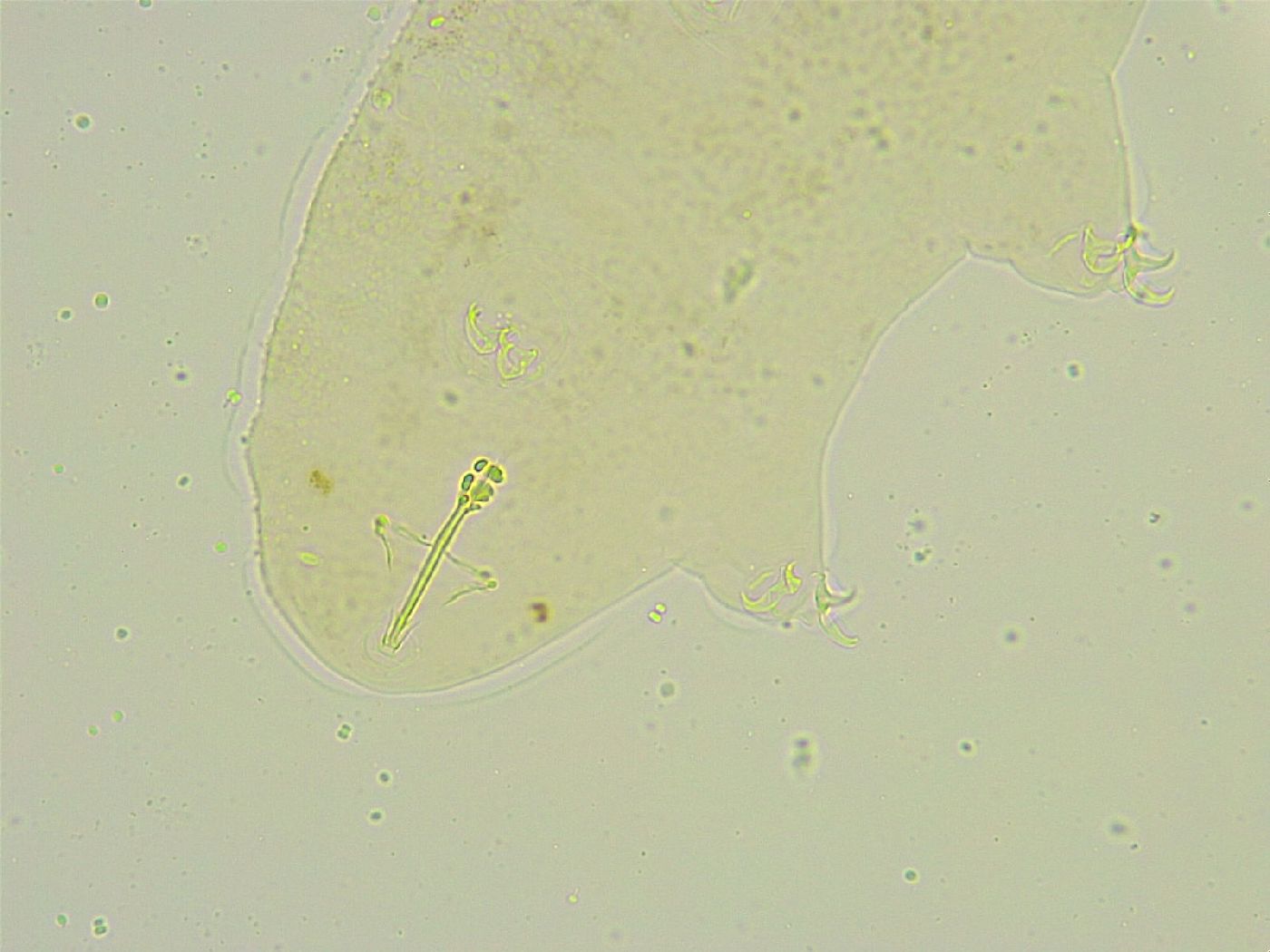 Isohypsibius tuberculatus image