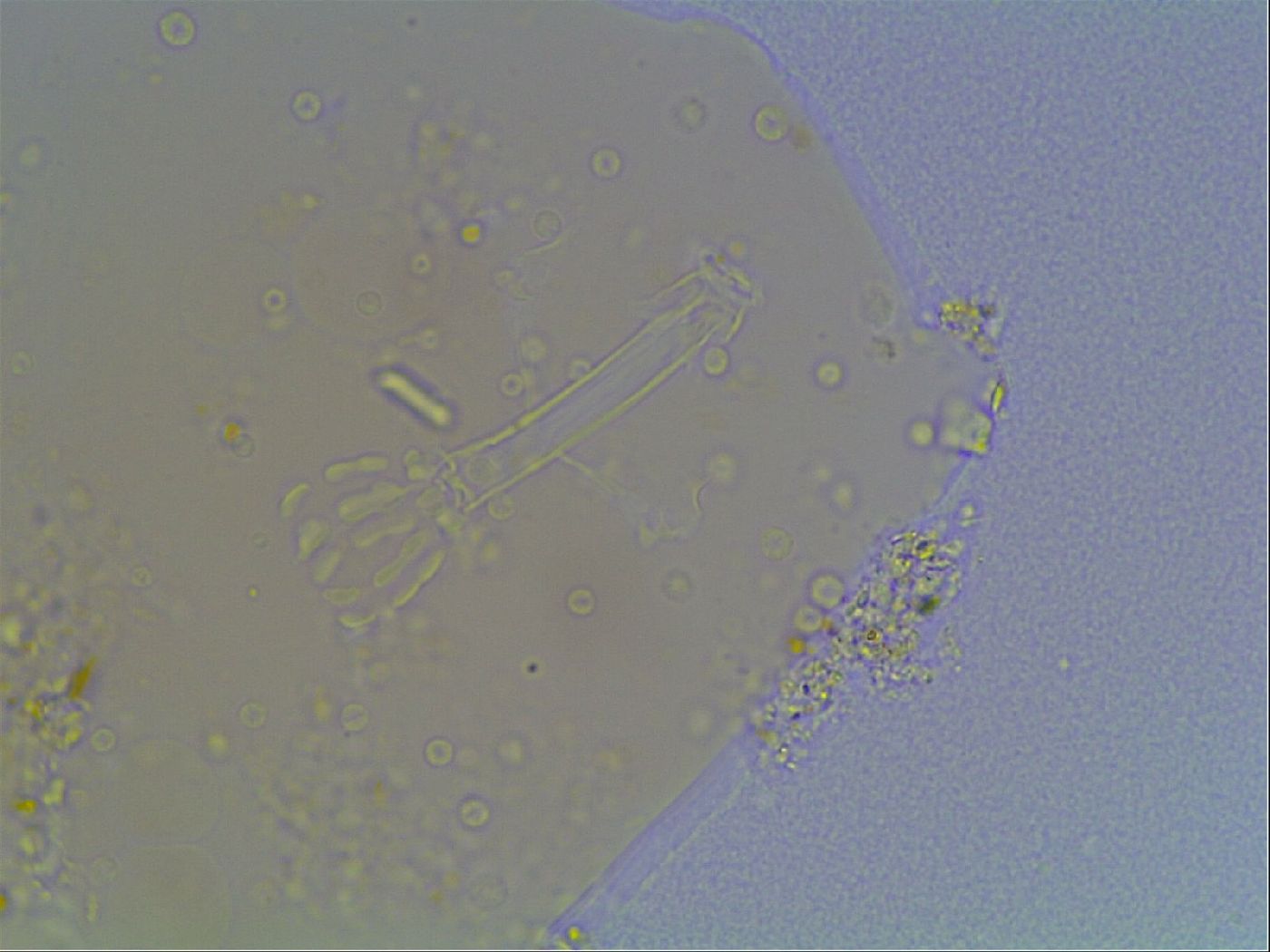 Macrobiotus anderssoni image