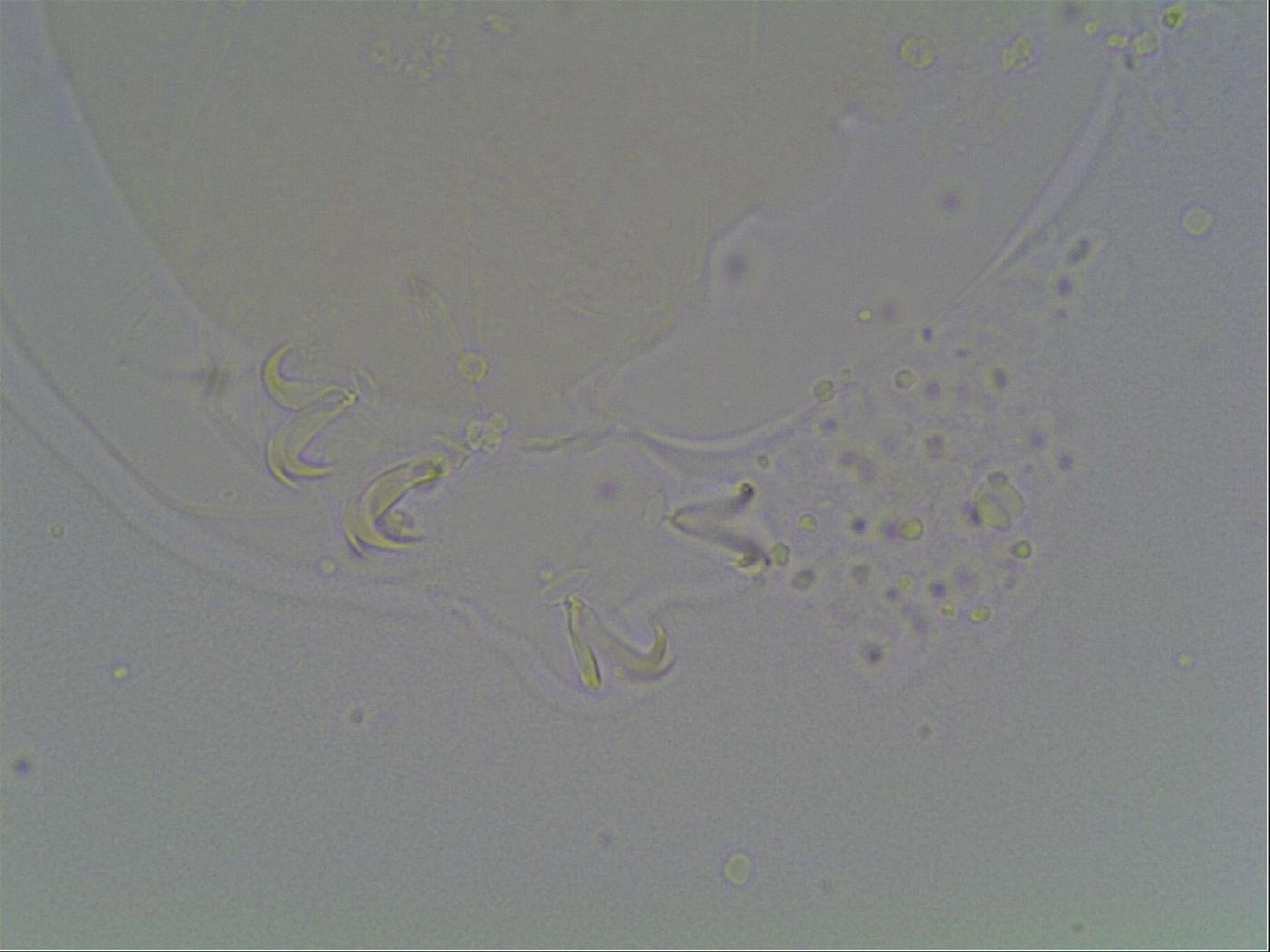 Macrobiotus anderssoni image