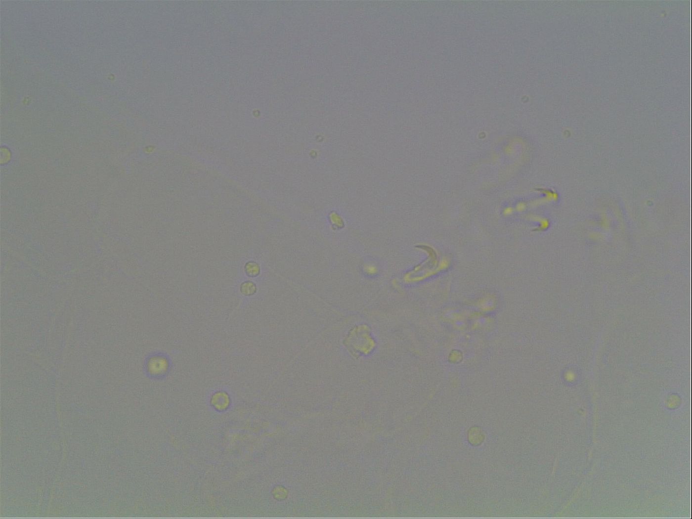 Macrobiotus anderssoni image