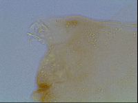 Macrobiotus anderssoni image