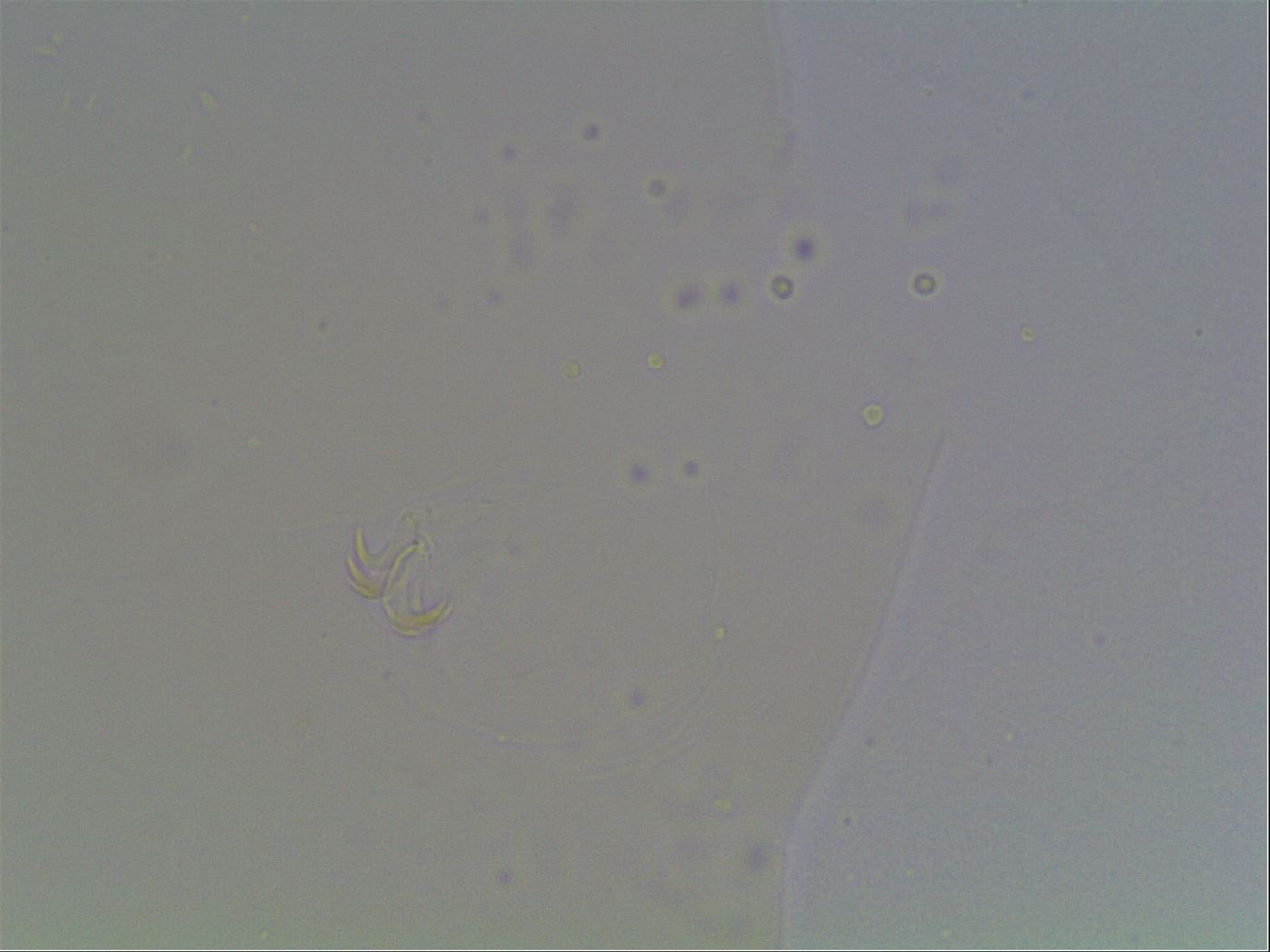 Macrobiotus anderssoni image