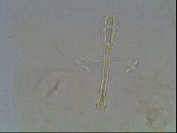 Macrobiotus anderssoni image