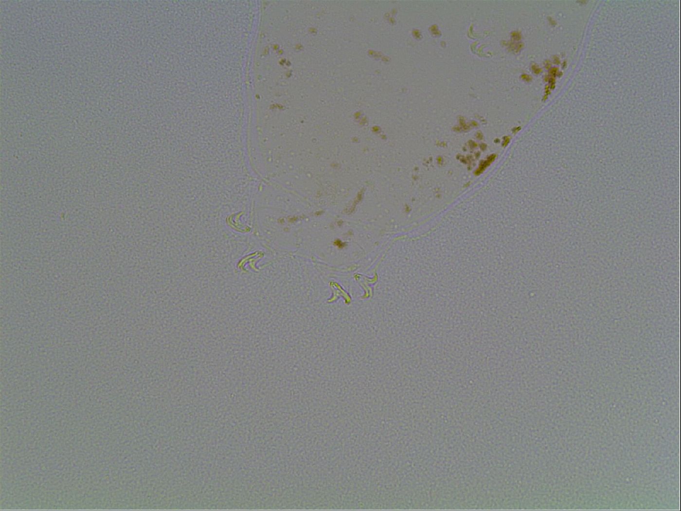 Macrobiotus anderssoni image
