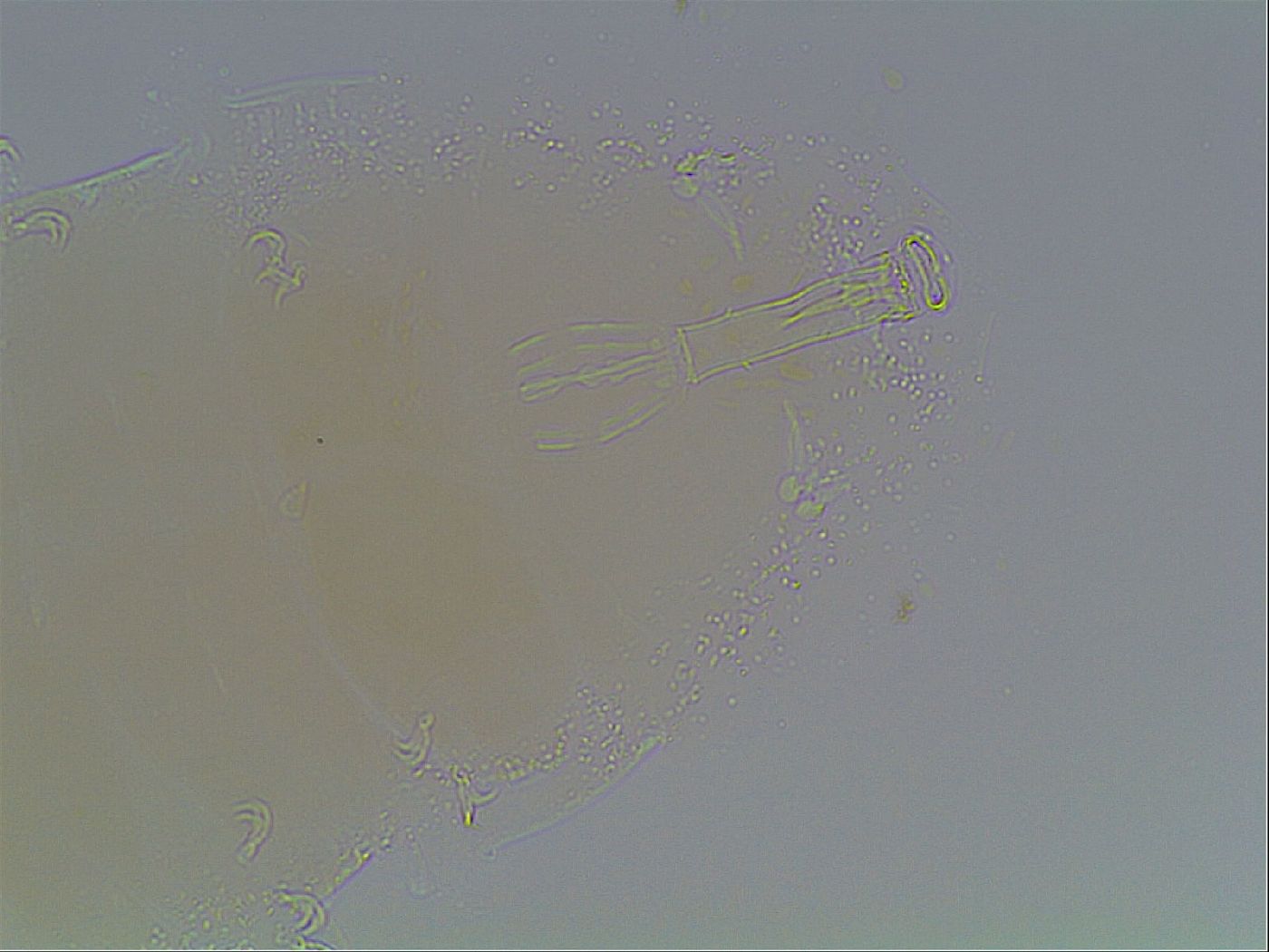Paramacrobiotus areolatus image