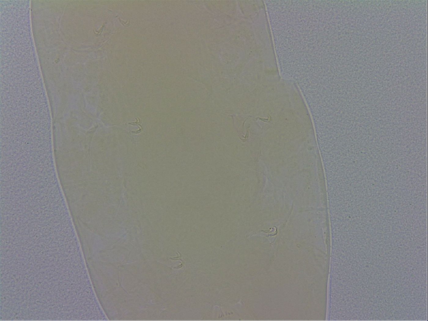 Minibiotus aculeatus image