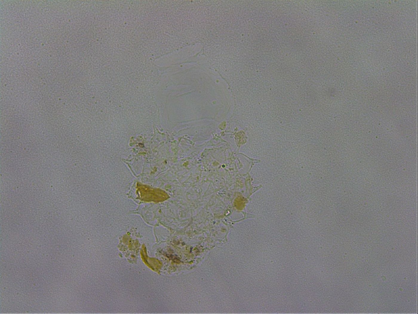 Paramacrobiotus areolatus image