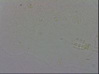 Mesobiotus furciger image