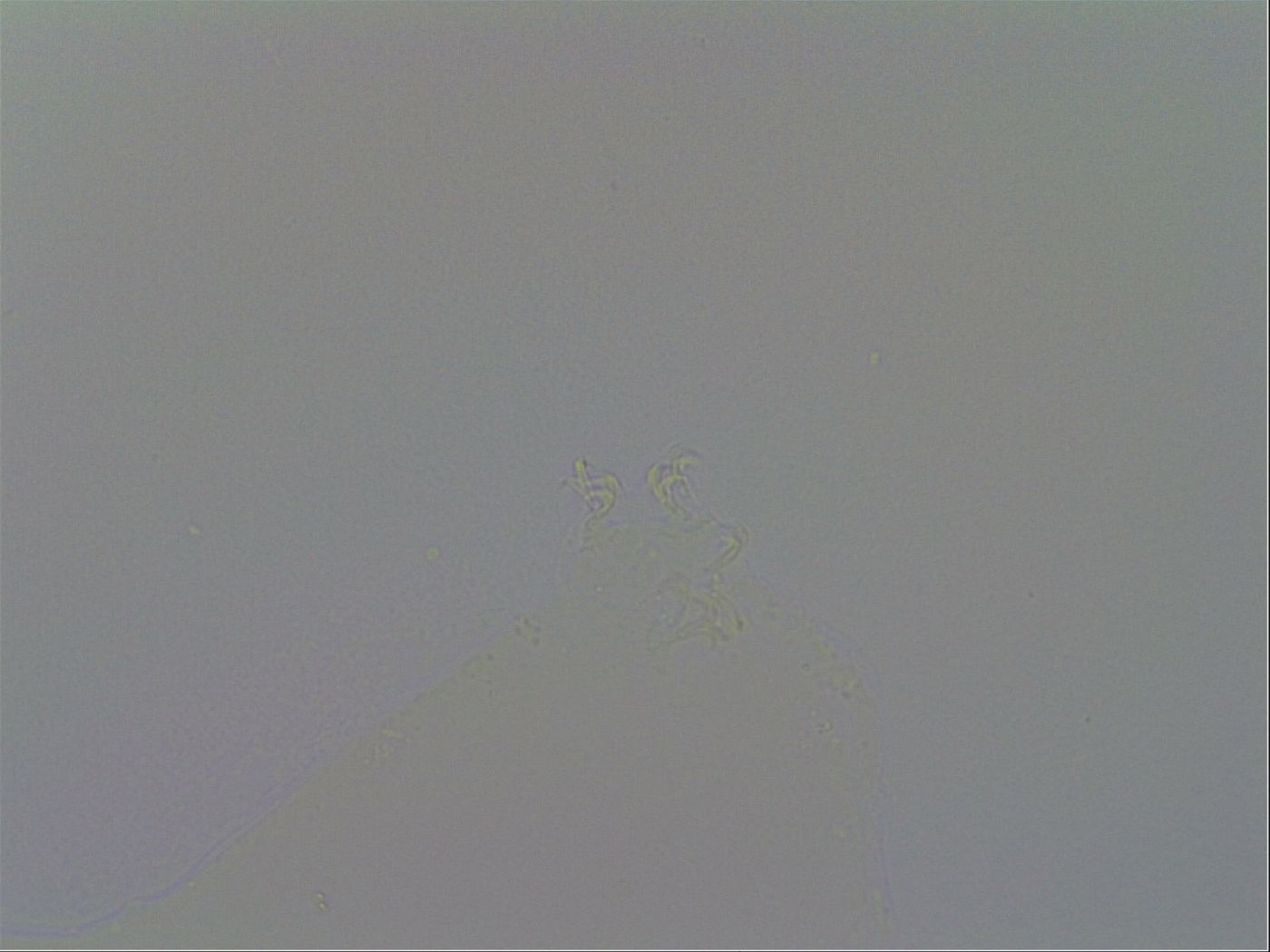 Macrobiotus echinogenitus image