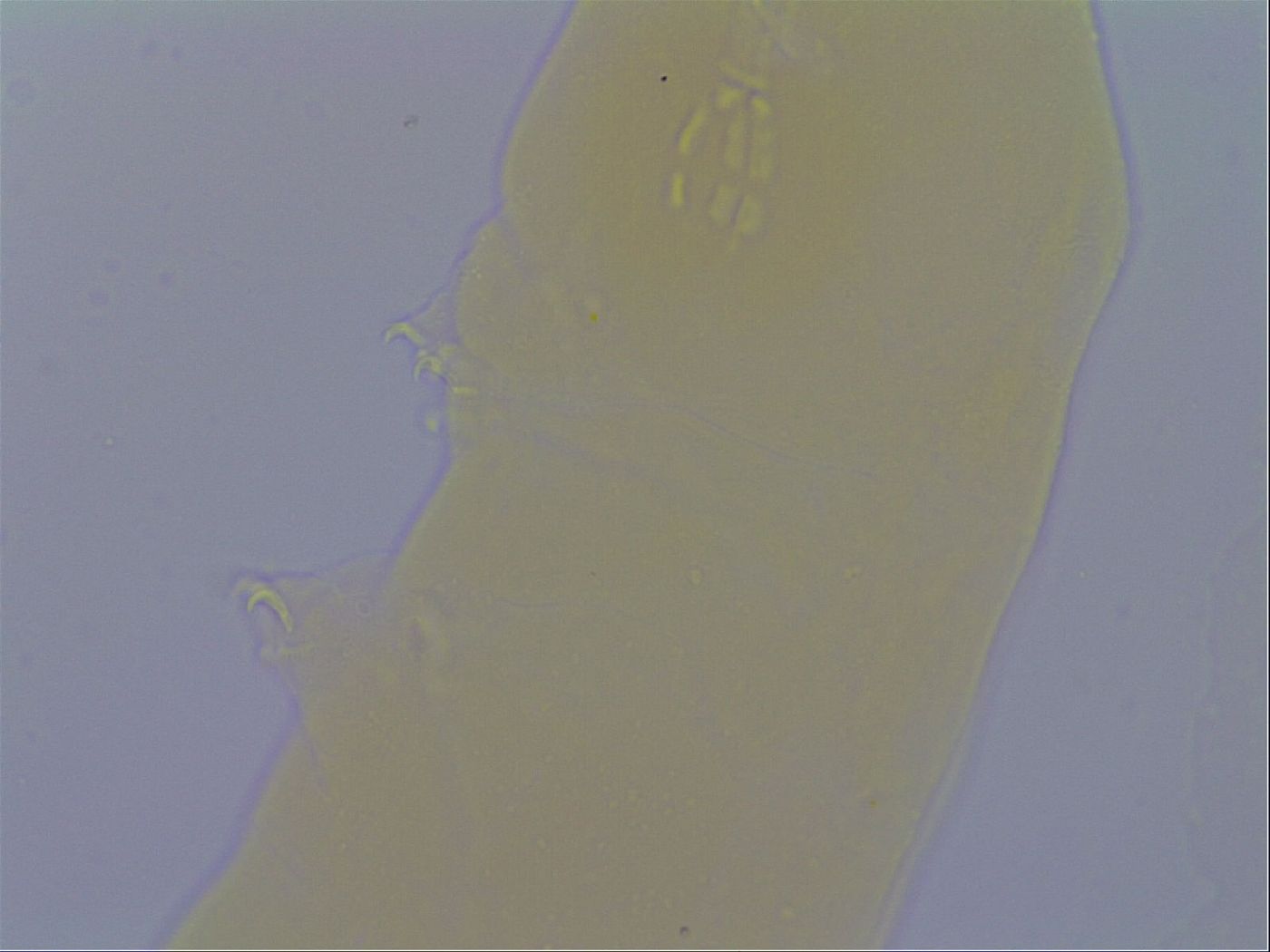 Macrobiotus echinogenitus image