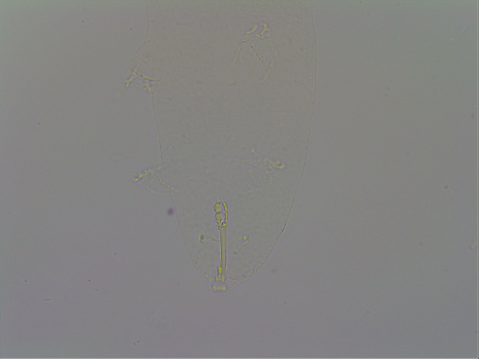 Macrobiotus echinogenitus image