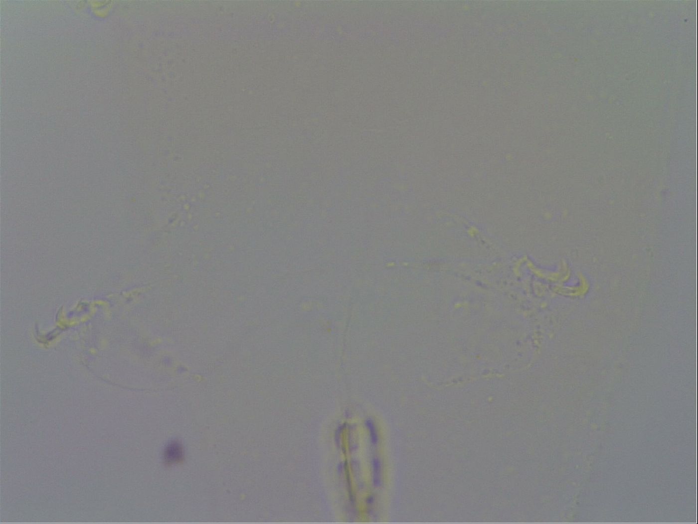 Macrobiotus echinogenitus image