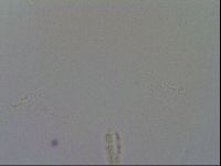 Macrobiotus echinogenitus image