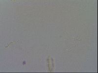 Macrobiotus echinogenitus image