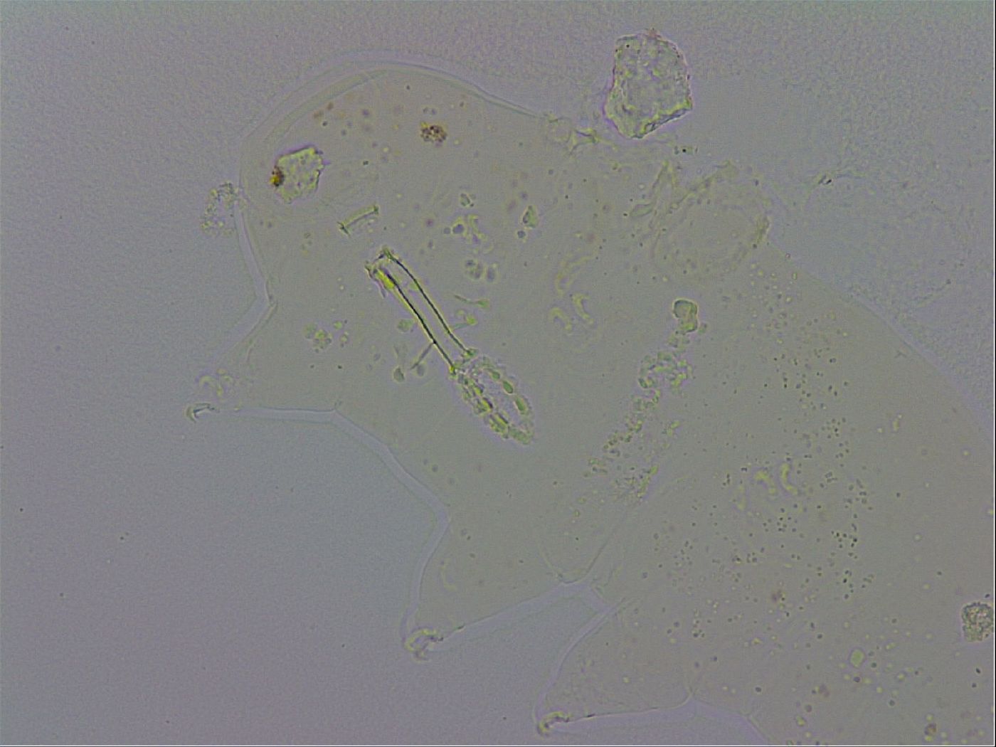 Mesobiotus furciger image