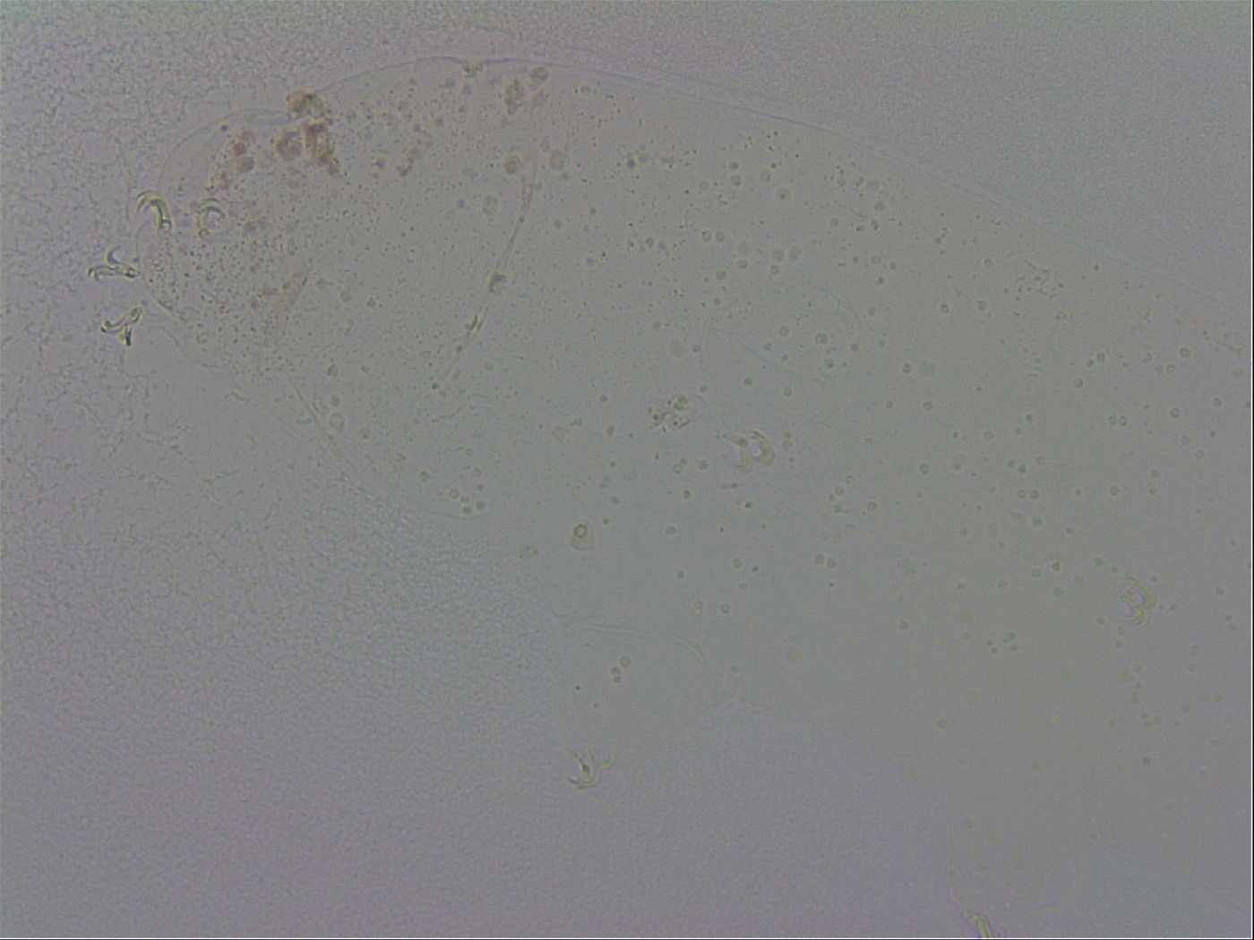 Mesobiotus furciger image