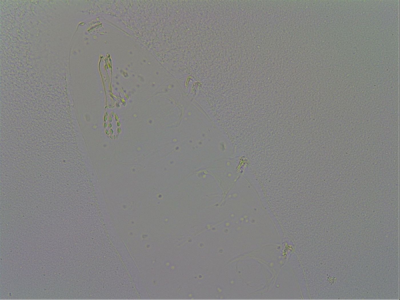 Mesobiotus furciger image