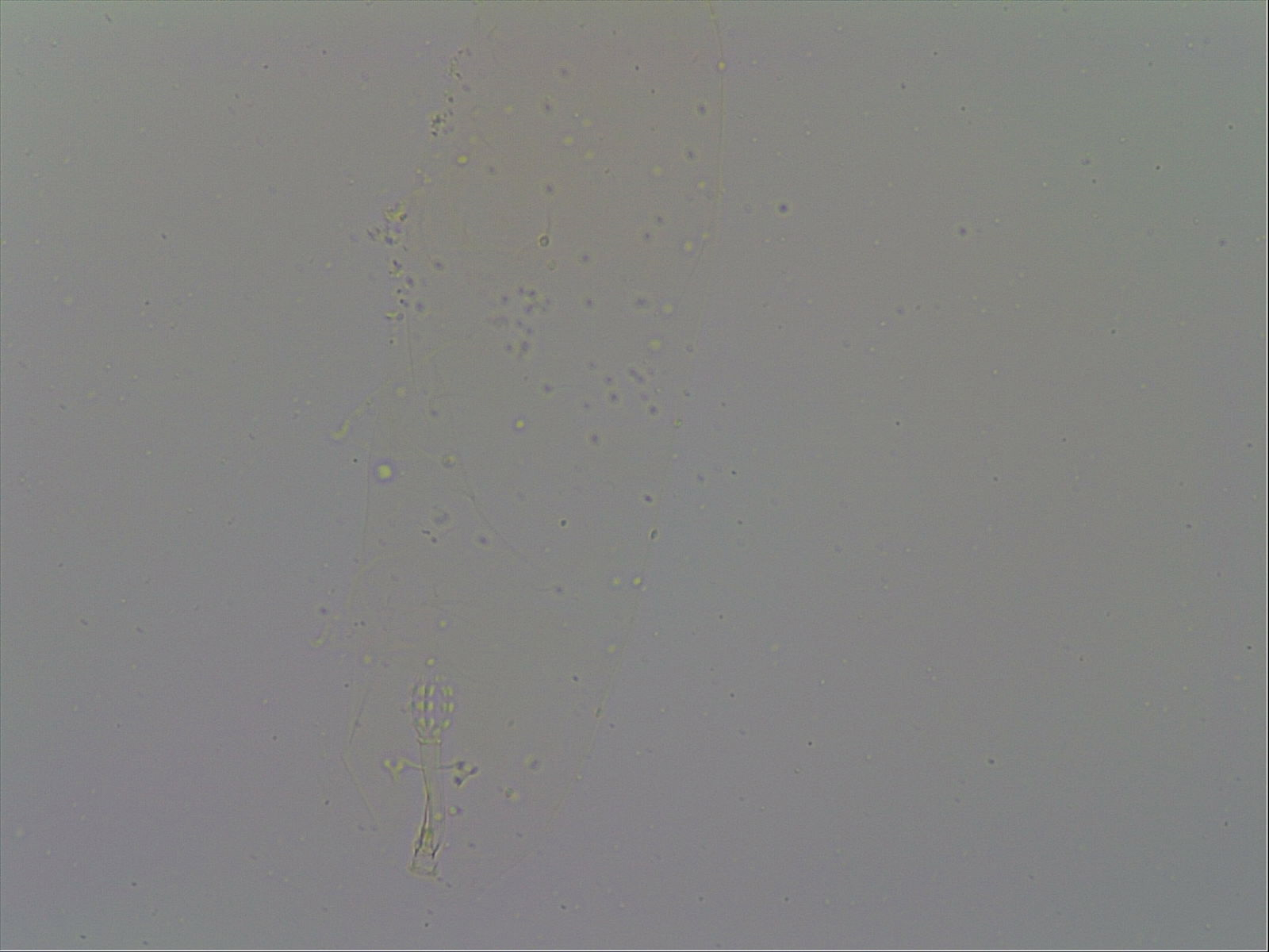 Mesobiotus furciger image