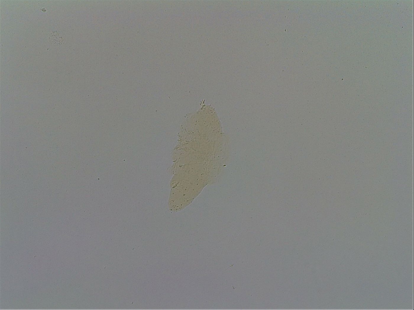 Mesobiotus furciger image