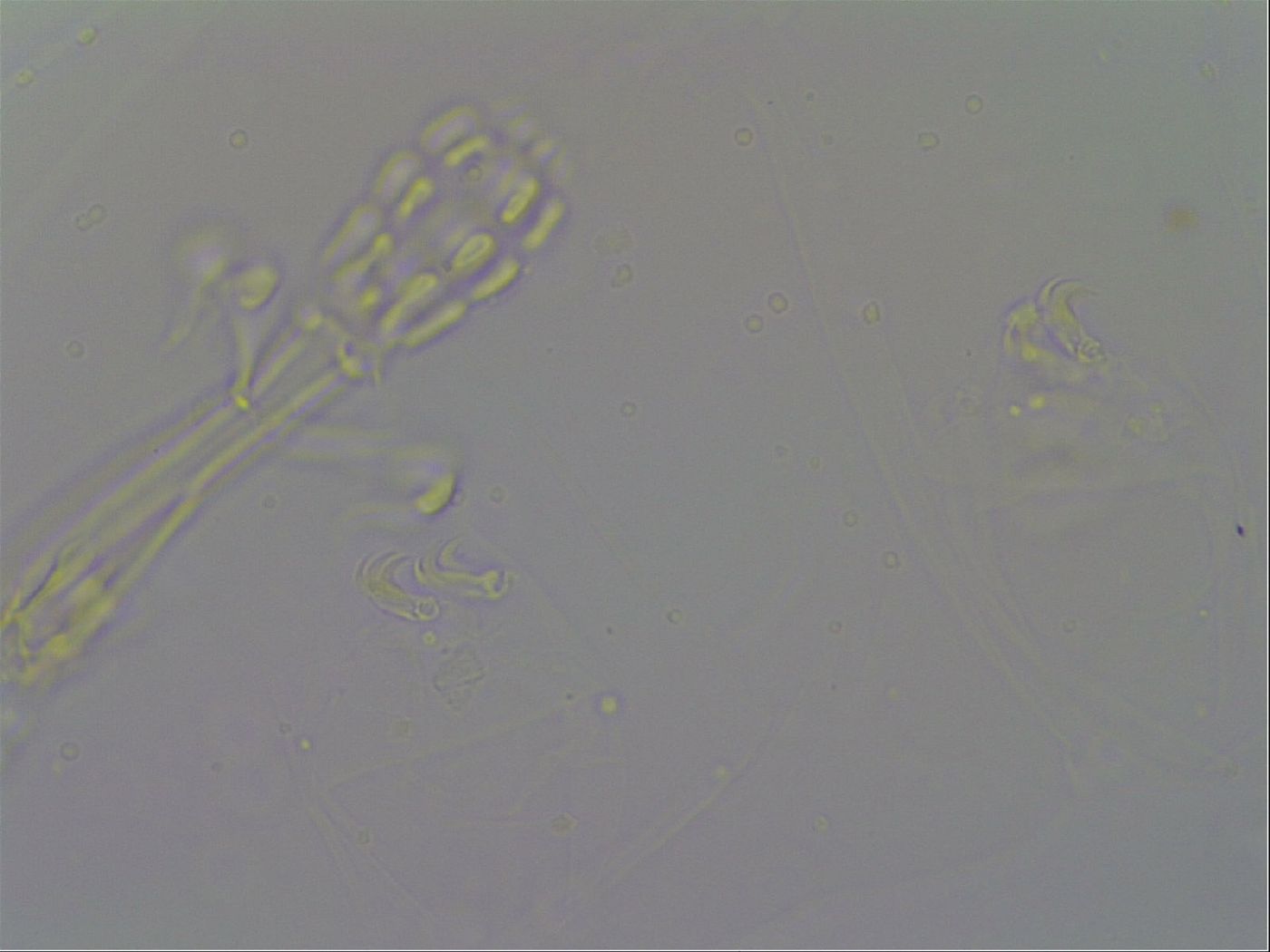 Mesobiotus furciger image