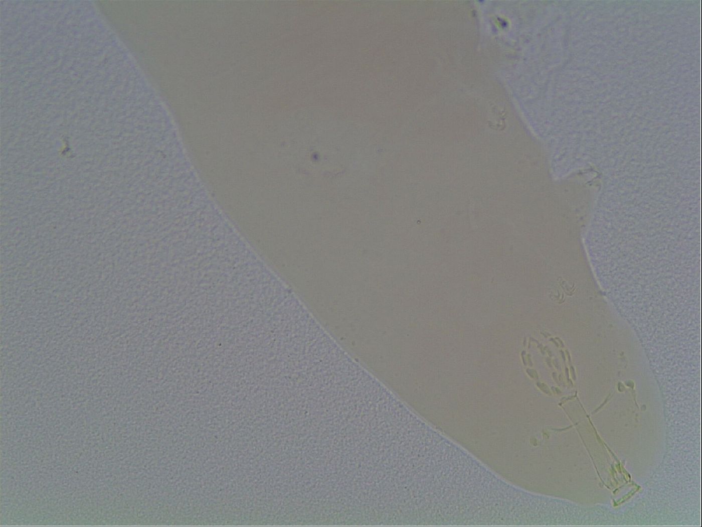 Mesobiotus furciger image