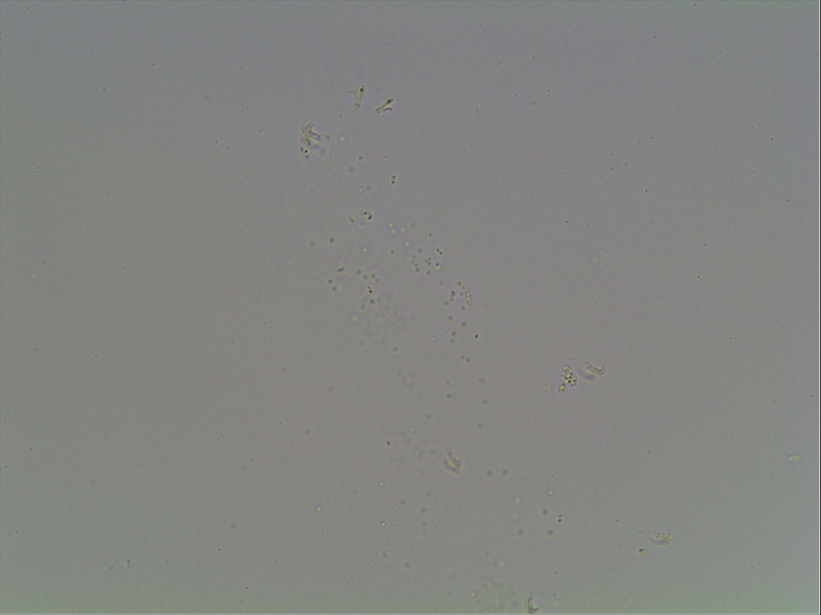 Mesobiotus furciger image