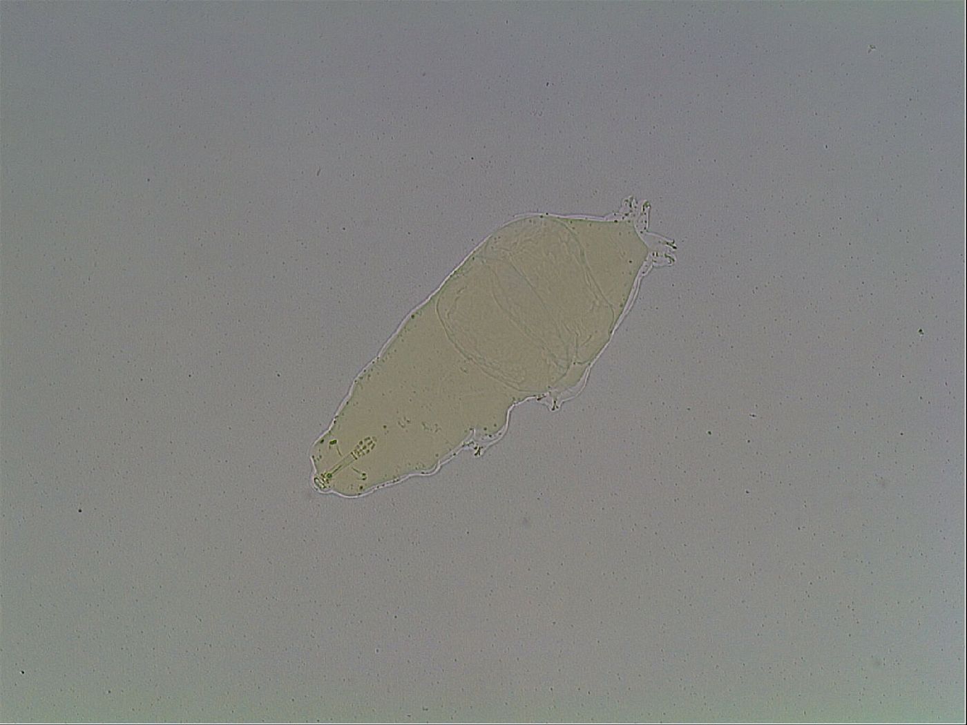 Mesobiotus furciger image