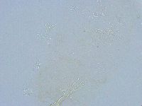 Thulinius saltursus image