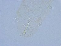 Thulinius saltursus image