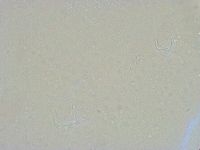 Thulinius saltursus image