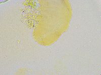 Thulinius saltursus image