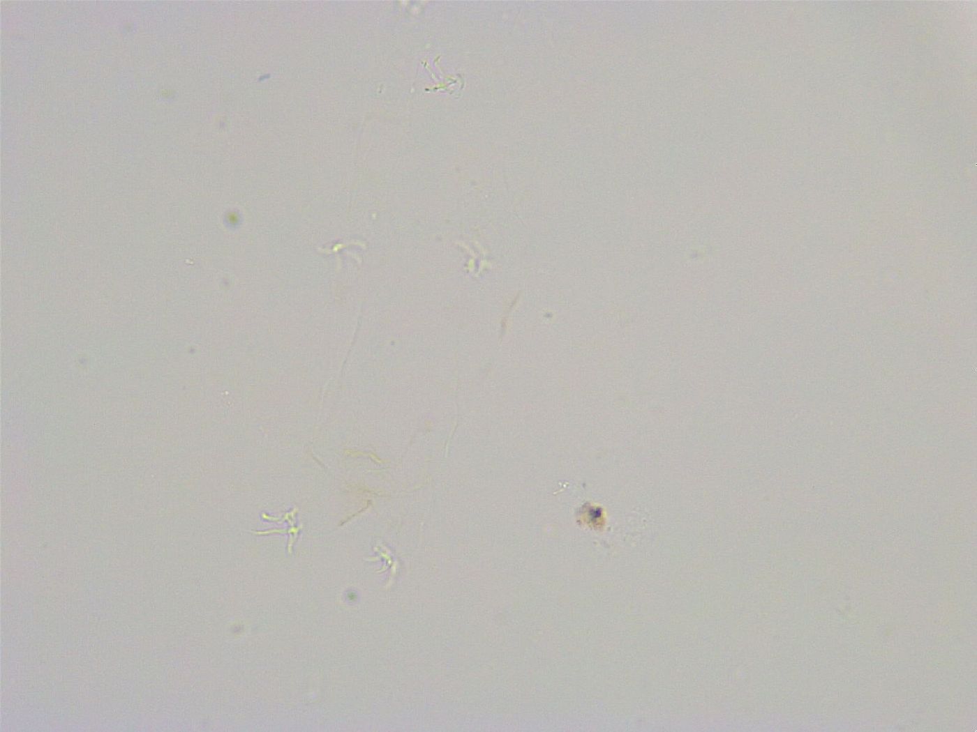 Thulinius saltursus image