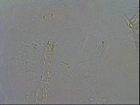 Macrobiotus psephus image