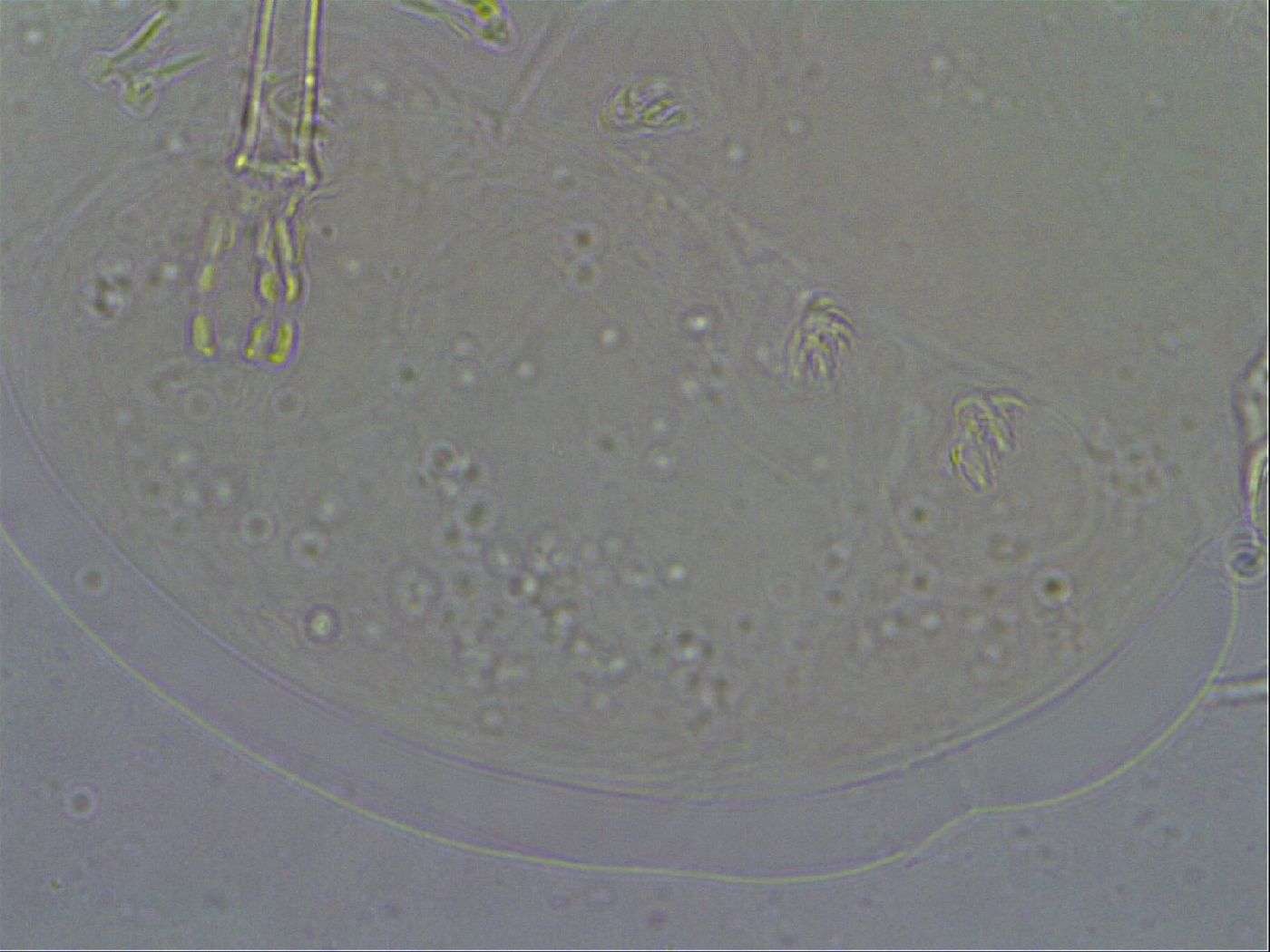 Macrobiotus psephus image
