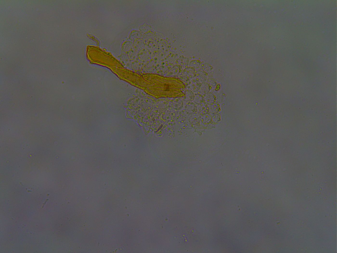 Paramacrobiotus areolatus image
