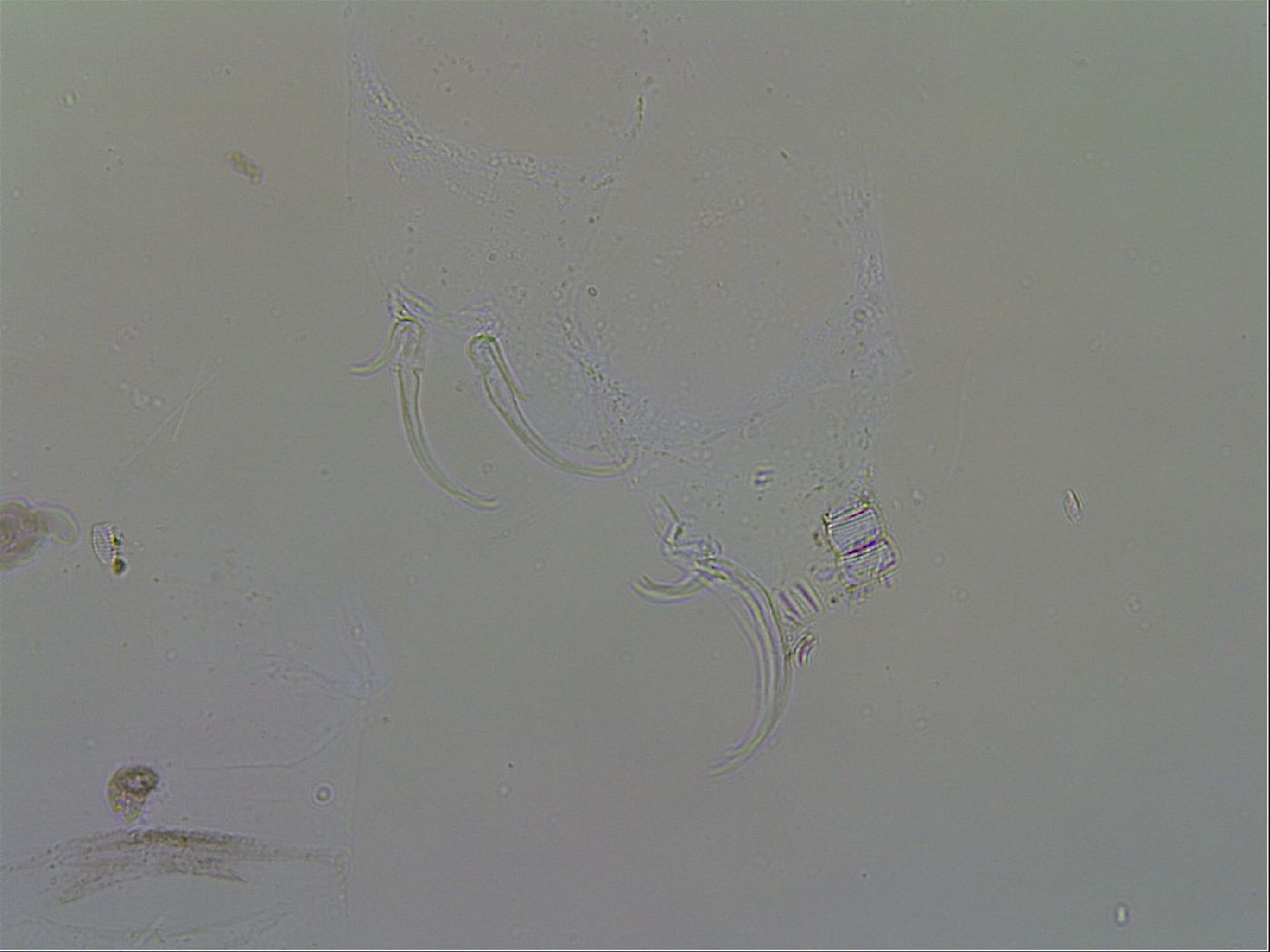 Adorybiotus granulatus image