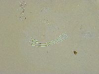 Adorybiotus granulatus image