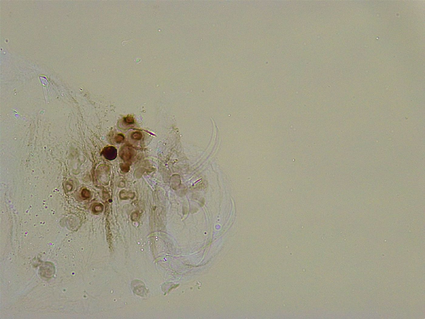 Adorybiotus granulatus image