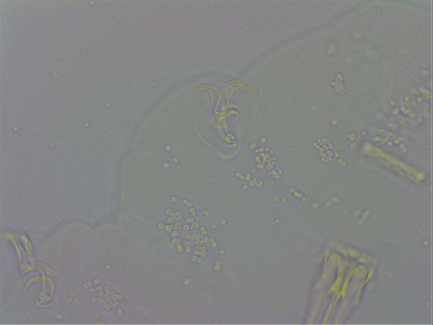 Mesobiotus coronatus image