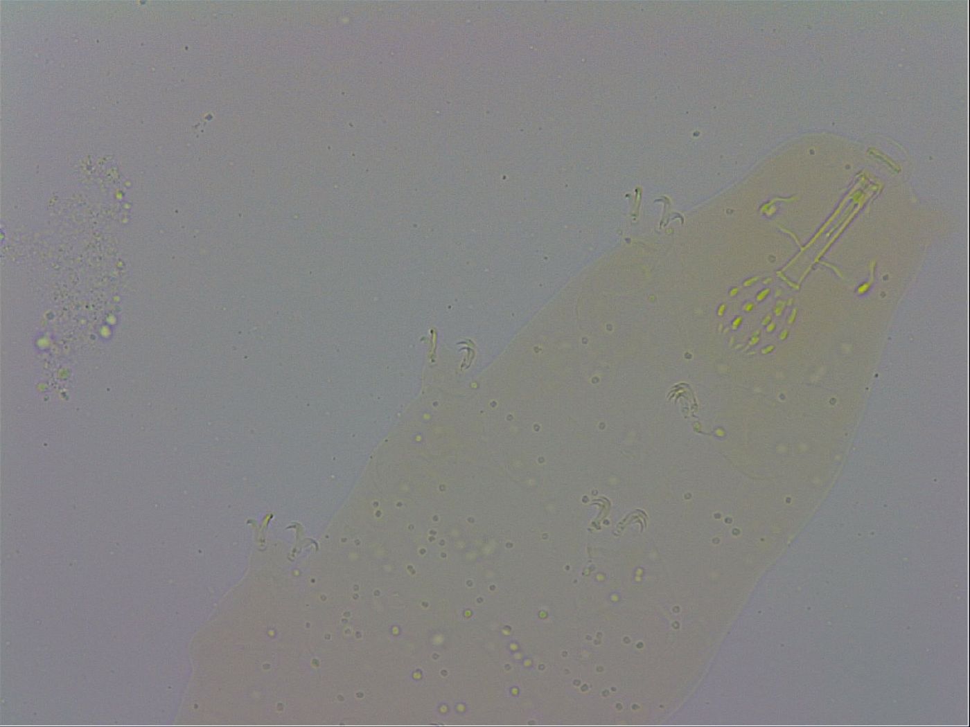 Mesobiotus coronatus image