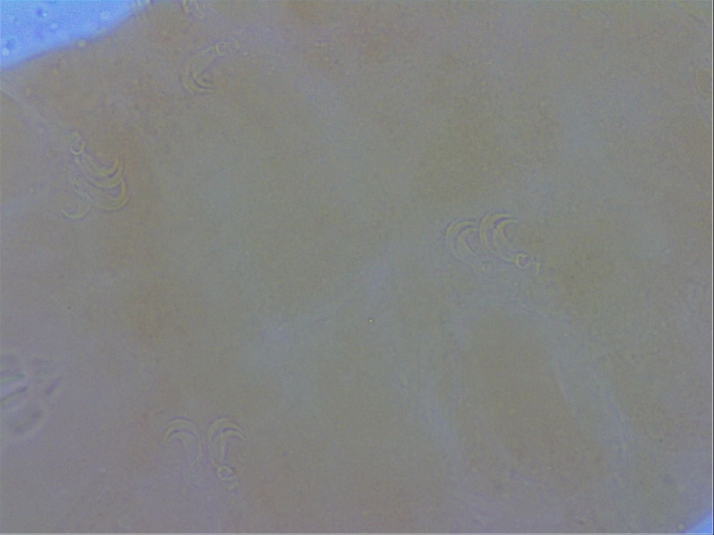 Mesobiotus coronatus image