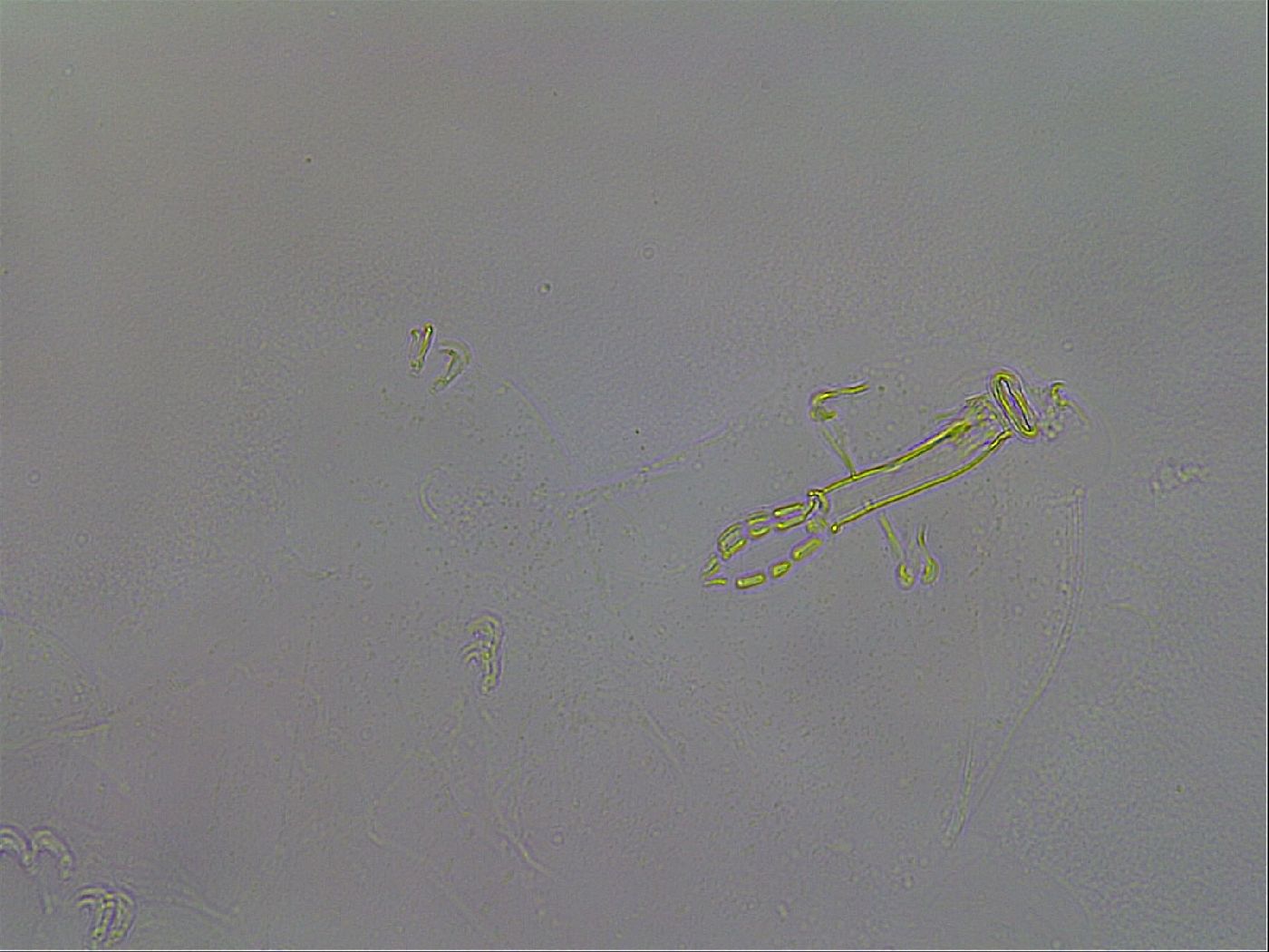 Mesobiotus coronatus image