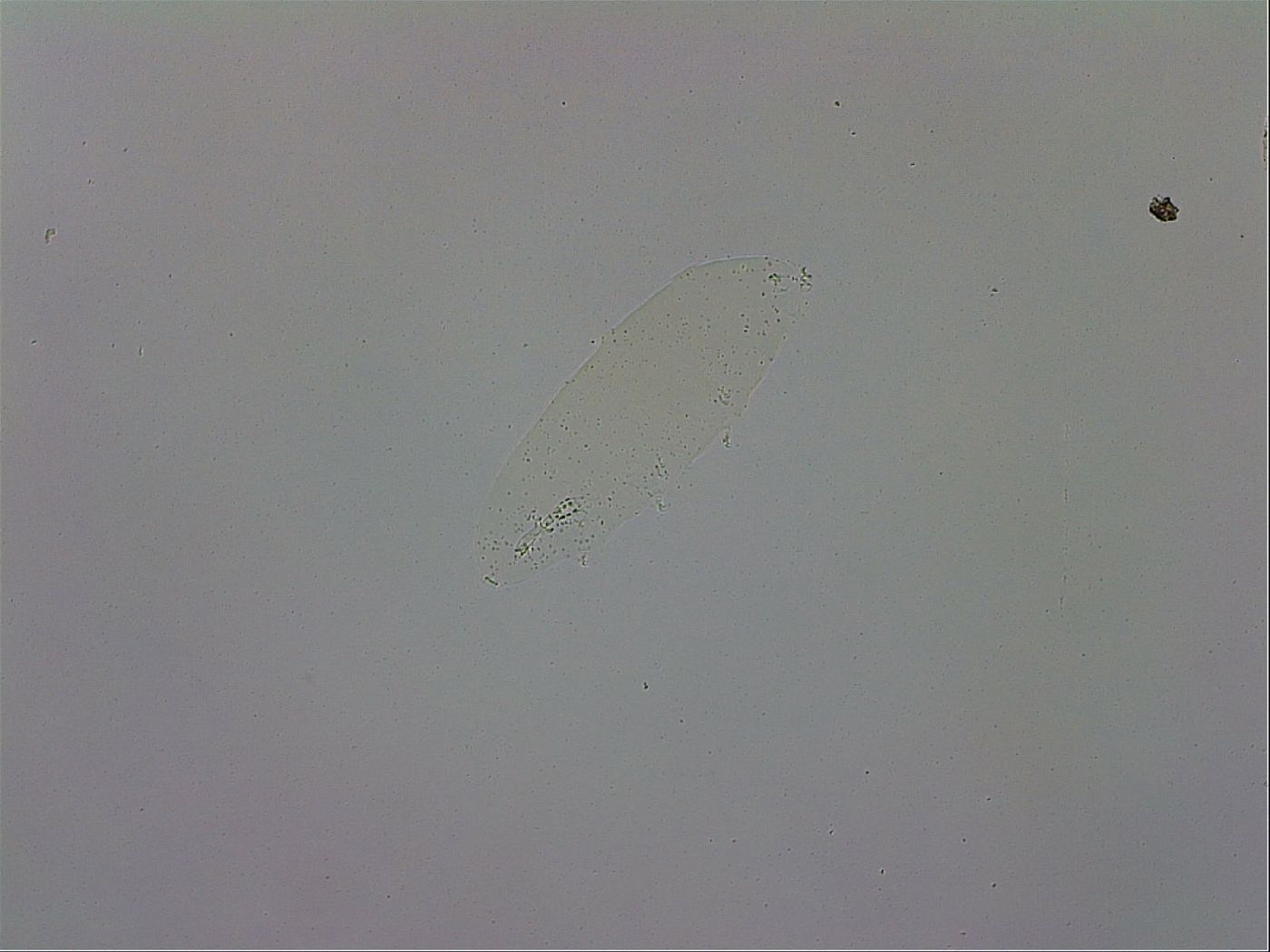 Mesobiotus coronatus image